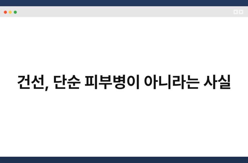 건선, 단순 피부병이 아니라는 사실 4